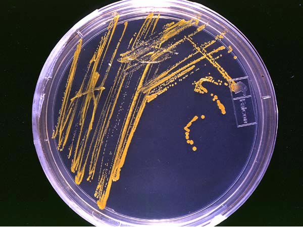 dish with bacterial growth